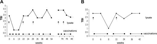 Figure 5. Correlation of vaccine application with clinical response. Correlation of disease development as assessed by TBI and vaccine application was followed over time. Interruption of vaccination led to disease progression with increased TBI. Repeated response was induced after revaccination (•——•) with new tumor lysate (↑) from progressive lesions. In patient 1, interruption of vaccination led to progression of disease (A, week 13). Introduction of a new vaccine using DCs pulsed with tumor lysate of a progressing lesion (A, week 29) induced a treatment response. A similar observation was made in patient 2, when interruption of the vaccination led to disease progression (B, week 8). A change to new tumor lysate led to a clinical response after week 13 (B).