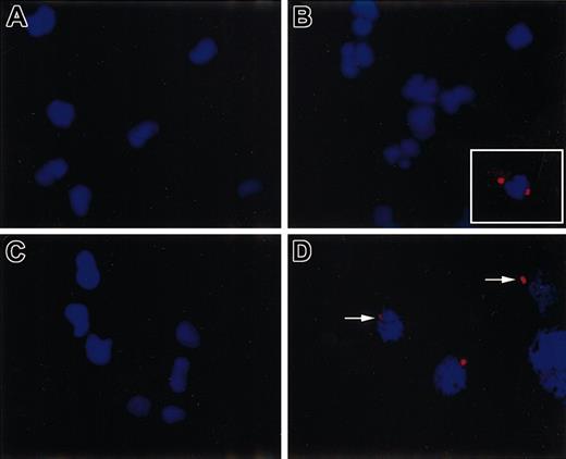 Figure 8. Identification of IFN-α production by intracellular staining of flow-sorted lymph node CD123+ pre-DCs after in vivo infection with influenza A virus. Staining of cytospin preparations of Flt3L-mobilized blood CD11c+ pre-DC (A) and CD123++ pre-DC (B) subsets flow-sorted from peripheral blood of rhesus monkeys 5 days after in vivo infection with influenza A virus shows no evidence of IFN-α production. Panel B inset shows IFN-α production (cytoplasmic red dots) in CD123++ pre-DCs mobilized by Flt3L and infected in vitro with HSV type-1 (Kos strain; 10 pfu/cell) as positive control for IFN-α production by DCs). In contrast to peripheral blood, intracellular IFN-α could be readily detected (arrows) in lymph node CD123+ pre-DCs (D) but not in CD11c+ pre-DCs (C) on day 3 after influenza infection. IFN-α was detected by immunofluorescence staining with biotinylated mouse antihuman IFN-α followed by streptavidin Cy3 conjugate (original magnification × 1000 for all panels).