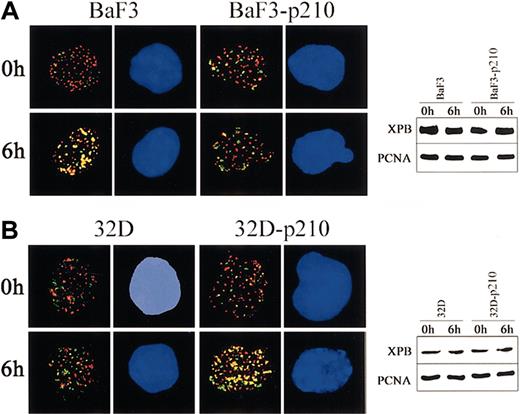 Figure 4. p210 BCR/ABL regulates the nuclear assembly of XPB and PCNA in response to UVC. (A) BaF3 and BaF3-p210 lymphoid cells and (B) 32D and 32D-p210 myeloid cells were irradiated or not with 10 J/m2 UVC. Nuclear localization of PCNA (red) and XPB (green) was detected on the cytospins prepared at time 0 and 6 hours after irradiation. DNA was counterstained by DAPI. Yellow color indicates the possible colocalization sites on PCNA and XPB. Results represent 2 independent experiments. Original magnification, × 1000. Expression of PCNA and XPB in total cell lysates before and after UVC was detected by Western analysis.