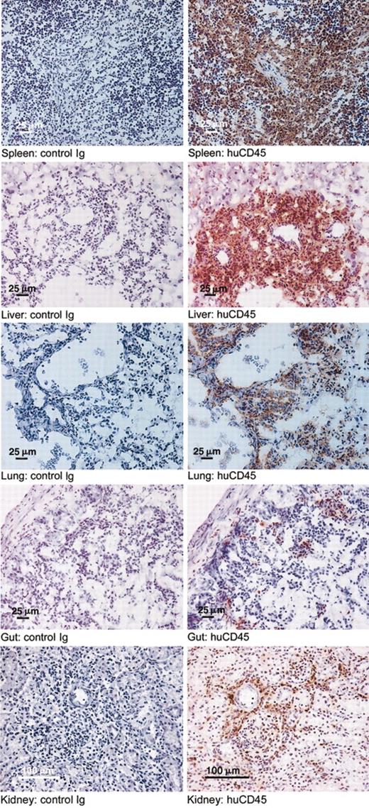 Figure 4. Infiltration of human CD45+ cells in the organs of the huPBMC-RAG2-/- γc-/- chimeras. Immunohistochemical evaluation (huCD45) was performed in 15 mice in the third experiment. Infiltration of human CD45+ cells at day 16 is shown in the various organs of the mice (right) compared with control slides (left). Original magnification, × 10.