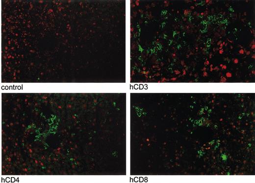 Figure 5. Immunofluorescent imaging of infiltration of human CD3+, CD4+, and CD8+ T lymphocytes in the liver of a mouse with acute X-GVHD. Immunofluorescent imaging was performed of the lungs, liver, and spleen of 5 mice with acute X-GVHD in the third experiment. Infiltration of human T lymphocytes, indicated by green fluorescence, was present at day 16 in all organs. An example is shown of infiltration of human CD3+, CD4+, and CD8+ T lymphocytes in the liver of one mouse compared with a control slide. Original magnification, × 10.