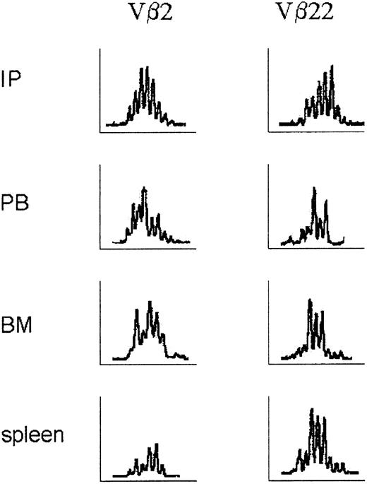Figure 6. Molecular analysis of the Vβ repertoire of human T-lymphocyte receptors before and after engraftment. RNA was isolated from single-cell suspensions of PB, BM, and spleen as described in “Materials and methods.” Patterns of Vβ families of T lymphocytes in the initial population of huPBMCs and after engraftment in PB, BM, and spleen, measured as the relative fluorescence intensity, showed a Gaussian distribution indicative of a polyclonal repertoire of T-cell receptors. Vβ2 and Vβ22 are depicted as representative examples. Other Vβ families showed similar patterns.
