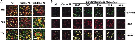 Figure 2. Neutralization of endogenous CCL2 results in cytoskeleton rearrangements and cell size modification in MDMs. (A) Dual-fluorescence CLSM analysis was performed on fixed MDMs double stained for α-tubulin (green) and actin (red) at different time points of culture. Shown is 1 representative experiment of 3 performed. (B) Dual fluorescence CLSM analysis was performed on MDMs maintained in the presence of different concentrations of the Ag affinity-purified polyclonal Ab to CCL2 or control Ab for 72 hours, fixed and double stained for α-tubulin and actin. The bars, indicated in the lower right panels, correspond to 20 μm.