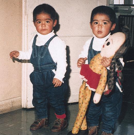 Figure 12. Twins who contributed to this study. These twins from Chile were the first to be recorded with a shared clonotypic leukemic marker, MLL-AF4 fusion. They are patients no. 1 in Figure 7. Reproduced with permission of the parents and the referring clinician.
