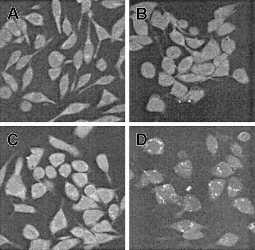Figure 2. Translocation of scFv-TAT through the cell membrane. RBL cells (untreated, panel A) were exposed for 90 minutes to anti-Bcl-2-scFv-TAT at different concentrations (5 μg/mL, panel C; 15 μg/mL, panel D), and to anti-Bcl-2-scFv (10 μg/mL, panel B). The translocation of anti-Bcl-2-scFv-TAT into the cell cytoplasm was visualized using protein A-FITC, seen in the figure as white dots (C-D). Cells were observed under a fluorescent microscope at ×40 magnification.