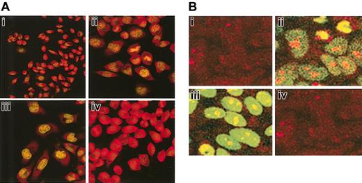 Figure 7. Induction of apoptosis in RBL and MCF7 cells after treatment with anti-Bcl-2-scFv-TAT. Cells were exposed to anti-Bcl-2-scFv-TAT or nonspecific scFv-TAT for 72 hours. Apoptosis was determined by TUNEL assay and the cells were observed under a fluorescent microscope at × 40 magnification. Untreated RBL (Ai) and MCF7 (Bi) cells. RBL (Aii) and MCF7 (Bii) cells exposed to DNaseI as positive control. The cells show DNA fragmentation and fluorescent labeling. RBL (Aiii) and MCF7 (Biii) cells treated with anti-Bcl-2-scFv-TAT. The nuclei of the cells show fragmentation and fluorescent staining. RBL (Aiv) and MCF7 (Biv) cells treated with nonspecific scFv-TAT. The cells show morphologic similarity to untreated cells.
