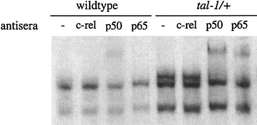 Figure 2. NF-κB activation in premalignant tal-1/scl transgenic thymocytes. Nuclear extracts were prepared from thymocytes from age-matched wild-type and tal-1 transgenic mice. The extracts were incubated with an oligonucleotide probe containing the NF-κB consensus sequence. The binding reactions were fractionated on a 5% polyacrylamide gel and the DNA-protein complexes were detected by autoradiography. The presence of NF-κB subunits was determined by supershifting with antibodies against p50, p65, and c-rel.