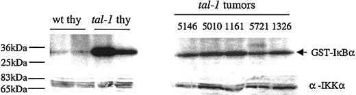 Figure 4. Increased IKK activation in premalignant tal-1/scl thymocytes and tumors. Thymocytes isolated from 4-week-old tal-1/scl transgenic and control littermates were lysed and immunoprecipitated with an anti-IKK-γ antibody and used in an in vitro kinase assay with GST-IκBα as the substrate. Whole-cell lysates were also prepared from tal-1/scl tumor cell lines. To insure that equivalent amounts of IKK were immunoprecipitated, the lysates were probed with an anti-IKK-α antibody.