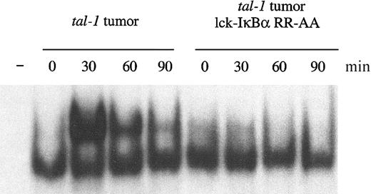 Figure 5. Mutant IκBα expression inhibits TNF-α-induced NF-κB activation in tal-1/scl tumors. Tal-1 tumor cells were electrophorated with lck-IκBα RR-AA-F-PEST and a plasmid encoding the neomycin resistance gene. Cells were selected for resistance to G418 and subsequently treated with TNFα for the time periods indicated. Nuclear extracts prepared from these cells were incubated with a radiolabeled NF-κB consensus oligonucleotide and fractionated on a 5% nondenaturing polyacrylamide gel.