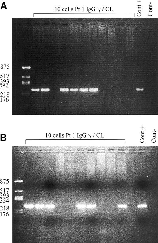 Figure 3. PCR amplification of EBER transcripts. EBV-specific transcripts are amplified by single cell PCR of sorted IgG anti-CL B cells (A) and IgM anti-CL B cells (B) and analyzed on ethidium bromide-stained agarose gels. Products are visible as bands of 253 bp. Negative control of PCR (Cont -) and positive control (Cont +) are shown: cells infected with the B95-8 strain of EBV are used for the positive control.