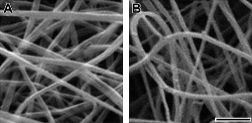Figure 3. SEM of fibrinogens. Scanning electron micrographs of normal (A) and BβArg14His (B) fibrinogens polymerized with thrombin. Clots used for scanning electron microscopy were formed with 0.4 mg/mL fibrinogen and 0.4 U/mL thrombin in 20 mM HEPES, pH 7.4, 150 mM NaCl, 1 mM CaCl2. SEM was performed as detailed in “Materials and methods.” Scale bar equals 1 μm.
