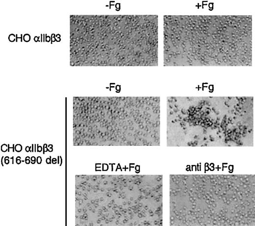 Figure 5. Soluble fibrinogen-dependent aggregation of CHO-αIIbβ3 (616-690del) cells. Cells (2.5 × 106/mL) were incubated without or with fibrinogen (1 mg/mL) for 15 minutes at room temperature in a final volume of 250 μL and then plated onto BSA-precoated wells. When indicated, cells were preincubated for 5 to 15 minutes with either 10 mM EDTA or 10 μg/mL anti-β3 antibody H1a. An irrelevant mAb was used as negative control (not shown). Aggregate formation was visualized by phase-contrast microscopy as described in “Materials and methods.” Original magnification, × 100.