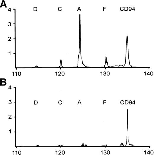 Figure 2. Two representative patterns of RT-PCR analysis of CD94 and NKG2 family, including NKG2A (A), NKG2C (C), NKG2D (D), and NKG2F (F). CD94+ NTENL expresses NKG2A strongly, and NKG2C and 2F weakly (A); a second NTENL expresses CD94 only (B).