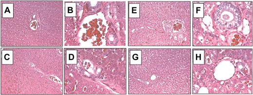 Figure 4. Histopathology of liver after hepatic infusion of the adenoviral HD vector AdFTC/cFIX/ChMAR. Representative histologic findings in liver samples obtained from hemophilia B dogs G11 and G21 5.5 months and 2 months after adenoviral administration, respectively. Hematoxylin and eosin staining of formalin-fixed liver sections from hemophilia B dog G11 (A-D) and dog G21 (E-H). (A) Liver 1, G11. (B) Liver 1, G11. (C) Liver 2, G11. (D) Liver 2, G11. (E) Liver 1, G21. (F) Liver 1, G21. (G) Liver 2, G21. (H) Liver 2, G21. Liver 1: caudate; liver 2: right medial. Original magnifications: × 100 (A,C,E,G); × 400 (B,D,F,H)