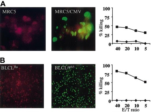 Figure 3. CMV-specific CTLs activated on AAPCs kill CMV-infected fibroblasts and recognize endogenously processed pp65. (A) Immunofluorescence staining for pp65 of uninfected control A2.1+ MRC5 fibroblasts (MRC5, left panel) or MRC5 infected with the CMV strain AD169 (MRC5/CMV, middle panel). Original magnification, × 40. More than 90% of MRC5/CMV stain positive for pp65, indicated by the green fluorescence. Staining was done immediately prior to cytotoxicity assays. Right panel shows cytotoxicity assays performed against MRC5 fibroblasts. CTLs activated on AAPCA2pp65 specifically lyse MRC5/CMV but not uninfected MRC5. ♦ indicates uninfected MRC5; ▪, MRC5 infected with CMV. (B) pp65 immunofluorescence staining in A2.1+ BLCLs transduced with the irrelevant flu peptide (BLCLflu, left panel) or with pp65 (BLCLpp65, middle panel). Original magnification, × 20. More than 95% of the BLCLpp65 stain positive. Right panel shows cytotoxicity assays performed against BLCLs shown on the left. CTLs specifically lyse BLCpp65 but not BLCLflu. ♦ indicates BLCLflu; ▪, BLCLpp65. Similar results were obtained for 3 different donors. A representative experiment is shown. Values represent average of triplicates.