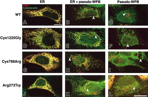 Figure 1. Subcellular distribution of WT and mutant rVWF. HEK293 cells were transiently transfected with either WT rVWF (A-C); rVWF-Cys1225Gly (D-F); rVWF-Cys788Arg (G-I); or rVWF-Arg273Trp (J-L), and were coimmunolabeled for VWF and the endoplasmic reticulum marker calreticulin. In panels A, D, G, and J, VWF exhibits ER staining only (in yellow); in panels B, E, H, and K, VWF exhibits ER (in yellow) and pseudo-WPB staining (in red; arrowheads); in panels C, F, I, and L, VWF exhibits pseudo-WPB staining only (in red; arrowheads). Bar is 20 μm.