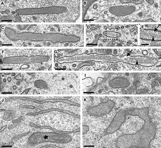 Figure 2. Pseudo-WPB formation after WT and mutant rVWF expression. HEK293 cells were transiently transfected with either WT rVWF in (A,B,J); rVWF-Cys1225Gly (C-E); rVWF-Cys788Arg (F-G), or rVWF-Arg273Trp (H,I,K), and were observed by transmission electron microscopy 2 days (WT, Cys788Arg, and Cys1225Gly) or 3 days (Arg273Trp) later. Sections were made en face, as shown in panels A-I, or in a pellet in panels J-K. Longitudinal sections of membrane-bound pseudo-WPBs with internal striations are shown in panels A-I. Note that in some of the pseudo-WPBs, there are few striations, as shown in panel G (arrowhead), or only one striation, shown in panels D-E (arrowhead), and that there is empty space in these organelles, shown in panels E and G (arrows). The inset in panel E shows as enlargement of the region boxed with a dashed line in panel D. After WT rVWF expression, the ER is normal as shown in panel J, but rVWF-Arg273Trp expression induces the deformation of the ER, which becomes swollen. The star in panel J indicates a mitochondrion. Scale bar is 200 nm (50 nm in panel E).
