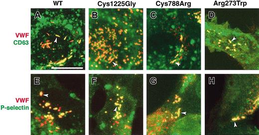 Figure 6. Membrane protein recruitment by WT and mutant rVWF. HEK293 cells were transiently cotransfected with either WT rVWF (A,E); rVWF-Cys1225Gly (B,F); rVWF-Cys788Arg (C,G); or rVWF-Arg273Trp (D,H). The cells were also transiently cotransfected with EGFP-CD63 (A-D) or HRP-P-selectin (E-H), and were immunolabeled for VWF (in red, panels A-H) and HRP (in green, panels E-H) 2 days later. The GFP in panels A-D (in green) was visible without staining. In each panel, the majority of pseudo-WPBs are yellow (arrowheads), indicating a colocalization of VWF and the marker. CD63 and P-selectin are also visible in other vesicles (as described in “Membrane protein recruitment”), where there is no colocalization with VWF. Scale bar measures 20 μm.
