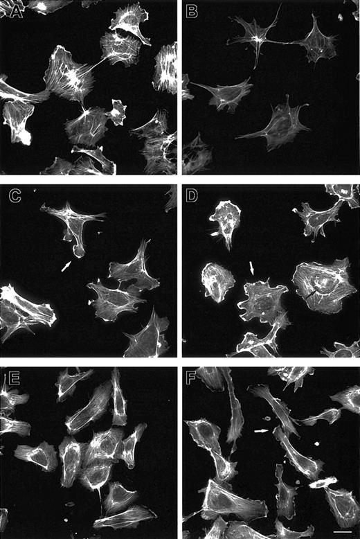 Figure 1. F-actin reorganization induced by Ang-1. ECs plated on gelatin-coated coverslips were maintained in 20% FCS (A) or starved for 1 hour in 0.5% FCS and stimulated with vehicle (B) or Ang-1 (20 ng/mL) for 2 (C), 5 (D), 90 (E), and 120 (F) minutes. Cells were stained with FITC-phalloidin. Bar indicates 10 μm. White and black arrows indicate lamellipodia and F-actin cables, respectively. Figure is representative of 3 experiments.
