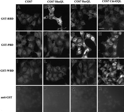 Figure 3. Immunolocalization of GST-RBD, GST-PBD, and GST-WBD in COS7 cells carrying RhoAQL, Rac1QL, and Cdc42QL. COS7 cells transfected with cDNA encoding RhoAQL (B,F,L,P), Rac1QL (C,G,M,Q), and Cdc42QL (D,H,N,R) were fixed, permeabilized, and incubated with GST-RBD (A-D), GST-PBD (E-H), or GST-WBD (I-N). Anti-GST Ab was used as negative control (O-R). Scale bar, 10 μm. There were 3 experiments performed with similar results.