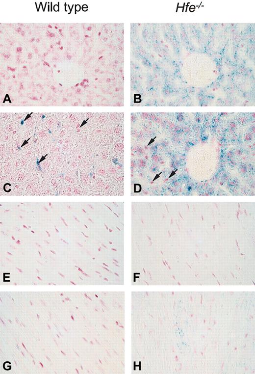 Figure 2. Iron storage in hepatic cells and heart after acute DOX treatment in wild-type and Hfe-deficient mice (Prussian blue staining). Light micrographs of liver (A-D) and heart (E-F) sections from saline-treated (A-B and E-F) or DOX-treated, day 4, (C-D and G-H) wild-type and Hfe-/- mice. In the livers of Hfe-/- mice, parenchymal cells with increased iron content after DOX treatment are visible around the portal spaces. In DOX-treated wild-type mice, iron could be detected only in 2 of 8 mice at day 4 (C) and 2 of 7 mice at day 12 and was found in Kupffer cells (arrows, C-D). In the heart, iron was detected in cardiomyocytes of DOX-treated Hfe-/- mice (H). Original magnification, × 400.