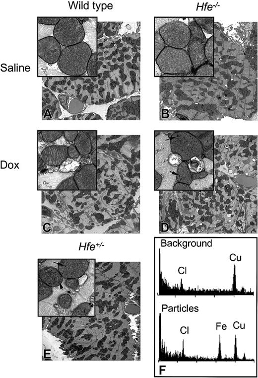 Figure 5. Ultrastructural changes in the mouse heart after chronic DOX treatment. TEM images of ultrathin sections of mouse hearts from saline-treated (A-B) and DOX-treated (C-E), nonsurviving wild-type (C), Hfe-/- (D), and heterozygous Hfe+/- (E) mice. Damaged mitochondria and electron-dense particles (magnified inset, D-E) are evident in DOX-treated mice (arrows). Original magnifications: × 5000 (A-E); × 25 000 (insets). (F) Analysis of the particles by energy-dispersive X-ray microanalysis in nonosmicated ultrathin sections obtained from the heart tissue from the same mouse shown in panel D. EDS spectra from background (top panel) and particles (bottom panel). Cl (chlorine) and Cu (copper) were detected in all samples; Fe (iron) was detected exclusively in the particles.
