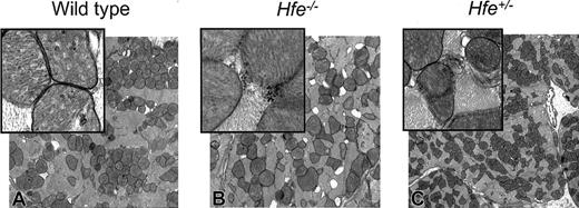 Figure 6. Electron micrograph of mouse heart from DOX-treated survivors. (A) Wild-type mice. (B) Hfe-/- mice. (C) Heterozygous Hfe+/- mice. Damaged mitochondria (magnified inset, B-C) are evident. Original magnifications: × 10 000 (A-C); × 50 000 (insets).