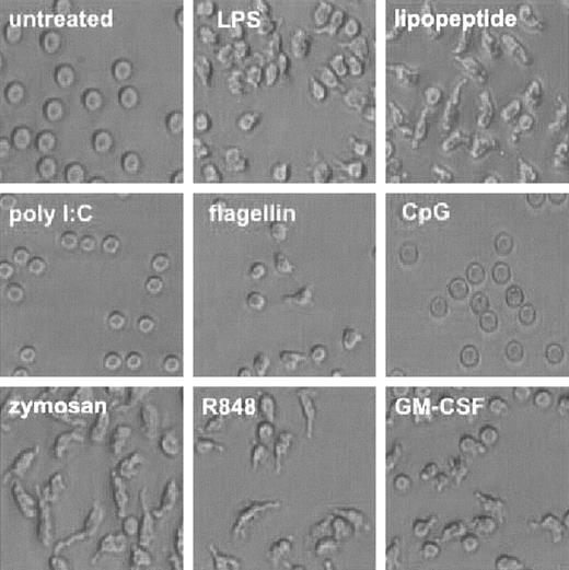 Figure 3. TLR agonists induce change in cell shape. Human neutrophils were isolated and treated with TLR agonists or GM-CSF as described in Figure 1. Cells were photomicrographed using phase contrast optics (original magnification, × 300). Representative of experiments performed on 3 donors.