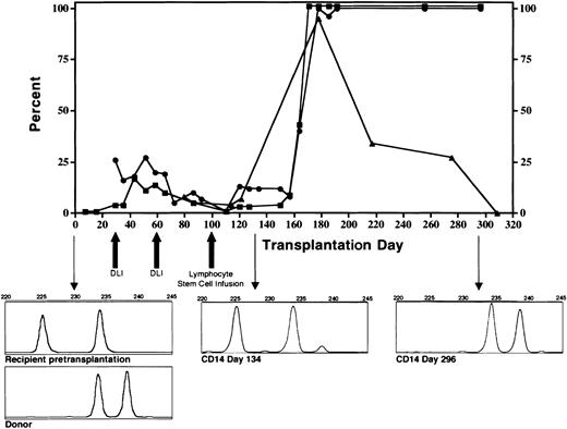 Figure 1. Engraftment of CD14+ donor monocytes (▪), CD15+ donor neutrophils (•), and percent cells positive for surface expression of interferon-γ receptor-1 on donor CD14+ monocytes (▴). Graft rejection was prevented by infusion of escalating doses of donor lymphocytes. Following full donor stem cell engraftment, surface expression of the interferon-γ receptor progressively diminished. Downward pointing arrows indicate microsatellite chimerism data prior to transplantation (accompanied by the donor pattern) day 134 and day 296 following the transplantation.