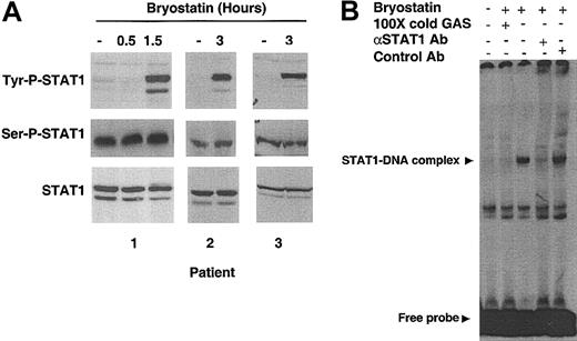 Figure 1. Bryostatin 1 induces tyrosine phosphorylation and DNA binding activity of STAT1. (A) Whole cell lysates from CLL cells treated with 10 nM Bryostatin 1 for 0.5 to 3 hours were analyzed by SDS-PAGE (sodium dodecyl sulfate–polyacrylamide gel electrophoresis) followed by Western blotting using antibodies specific for the tyrosine phosphorylated form of STAT1 (Tyr-P-STAT1), serinephosphorylated form of STAT1 (Ser-P-STAT1), or total STAT1 (bottom panel). Data from the 3 patients' cells shown are representative of results from 21 patients' cells. (B) DNA binding activity of nuclear extracts from CLL cells was examined by EMSA using a radiolabeled probe containing a GAS sequence. Cells were treated with 10 nM Bryostatin 1 as indicated. One hundred molar excess of unlabeled probe (100 × cold GAS) was used for competition experiments. Anti-STAT1 antibody was added to the binding reaction mix to verify that the protein-DNA complex contained STAT1. A control antibody (anti-STAT6) was used to verify specificity.
