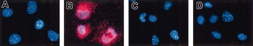 Figure 2. Immunofluorescence analysis of MARCO expression on LPS-activated D1 cells. D1 cells were grown on a glass coverslip. Immature (A,C) and 24-hour LPS-activated (B,D) D1 cells were stained with DAPI (4,6 diamidino-2-phenylindole), to identify the nuclei, and with the anti-MARCO mAb (A-B) or an irrelevant control (C-D). The MARCO expression was analyzed by fluorescence microscopy. Original magnification, × 400.