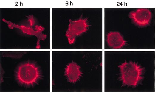 Figure 6. MARCO-transduced D1 cells do not undergo actin cytoskeleton rearrangements following LPS activation. D1 cells infected with the MARCO-expressing (MARCO-positive cells; bottom row) or empty (control cells; top row) PINCO vector were activated with LPS and stained for filamentous actin (red) at the indicated times following LPS activation. Original magnification, × 600.