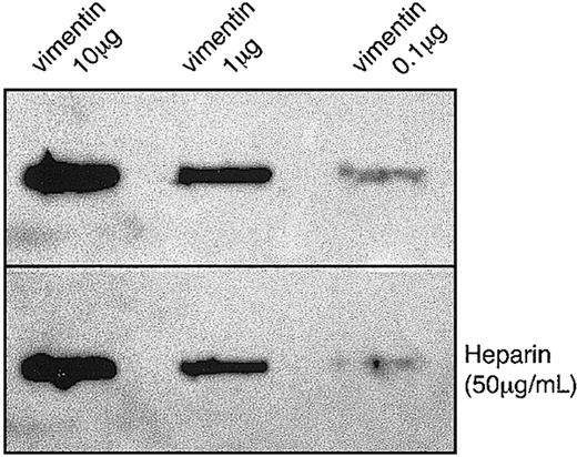Figure 3. hGIIA binding to purified vimentin is not inhibited by heparin. Indicated amounts of vimentin were spotted on a PVDF membrane and incubated with hGIIA (0.1 μg/mL) in the absence (top panel) or the presence (bottom panel) of heparin (50 μg/mL). The membrane was washed and probed with an anti-hGIIA antibody as described in “Materials and methods.”