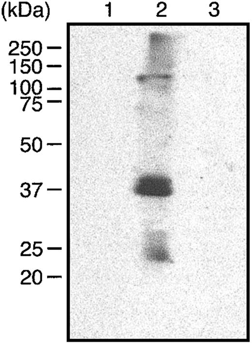 Figure 5. Far-Western analysis of the hGIIA binding domain on vimentin. Vimentin head (1), rod (2), and tail (3) domains were separated by SDS-PAGE and transferred to a PVDF membrane. The membrane was incubated with hGIIA (0.1 μg/mL) and probed with the hGIIA antibody as described in “Materials and methods.”