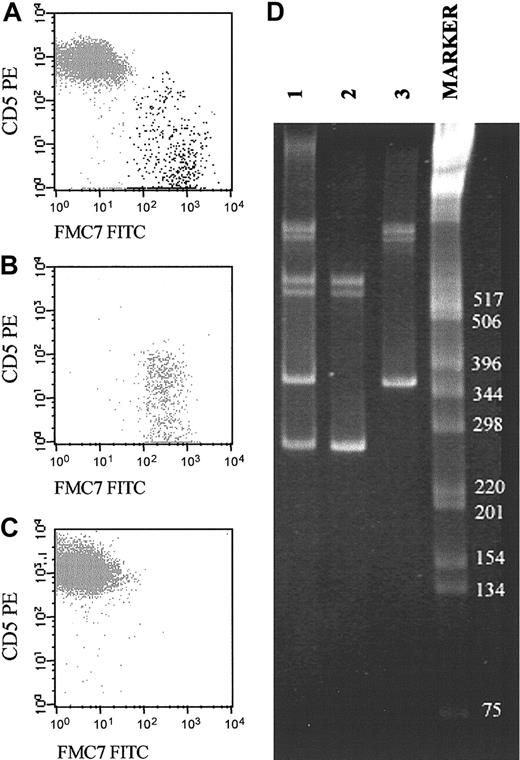 Figure 1. Representative example of a biclonal B-CLPD case initially suspected because of the presence of 2 phenotypically different B-cell populations (CD19+/CD5+/FMC7– and CD19+/CD5–/FMC7+). (A-C) The reactivity of both B-cell subsets for FMC7 and CD5 on CD19+ gated cells before (A) and after (B-C) sorting of each B-cell subset. CD5–FMC7+ cells are shown in panel B, and CD5+FMC7– cells are shown in panel C. (D) Molecular amplification of VDJH rearrangements of the IgH genes in the whole PB samples (lane 1) and the purified fractions of CD5–/FMC7+/CD19+ (lane 2) and CD5+/FMC7–/CD19+ (lane 3) FACS-sorted B cells are displayed. As shown, the 2 sorted B-cell populations had different VDJH gene rearrangements. The numbers to the right of the blot indicate kilodaltons.