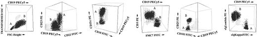 Figure 2. Illustrative 3-dimensional dot plots of samples from patients with several different leukemic B-CLPDs in which 2 distinct neoplastic B-cell clones were detected using immunophenotypic techniques. The neoplastic B-cell clones are named as A (one clone) and B (the second clone); other leukocytes present in the sample are shown as gray events.