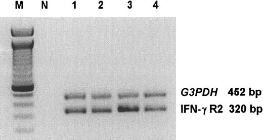 Figure 2. RT-PCR analysis of IFN-γR2 chain in malignant T cells. ST4 cells were cultured in complete medium (lane 1), in medium without serum (lane 2), in medium without serum supplemented with 100 ng/mL IGF-1 (lane 3), or in complete medium in the presence of 10 μg/mL anti–IGF-1R blocking mAb (lane 4). After 24 hours, cells were recovered and IFN-γR2 and G3PDH (housekeeping gene) mRNA were evaluated. Lane M indicates marker; lane N, contamination control reaction containing all PCR reagents but no substrate cDNA. The size of the PCR fragments is shown on the right.