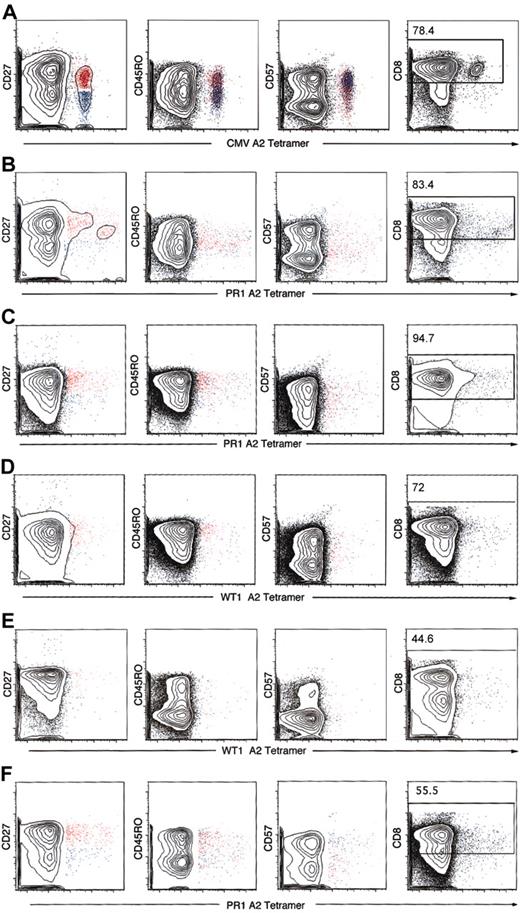Figure 4. Phenotypic characterization of tetramer-positive CD3+CD8+ T cells. Analysis of PBMCs was performed by 6-color flow cytometry in patients with CML patients before and after SCT and 2 healthy donors whose CD8+ T-cell frequencies to PR1 and WT1 were high enough to be visualized by tetramer staining. CD45RO, CD27, and CD57 phenotype of CD3/CD8-gated tetramer-positive lymphocytes was analyzed. Cells were gated on CD3+ lymphocytes, and the number in the top subpanel represents the percentage of CD3+ T cells that express CD8. Most of the CMV tetramer CD8+ T cells were CD45RO–CD27–CD57+ (blue), consistent with an effector memory phenotype (A). PR1 and WT1 tetramer-positive CD3+CD8+ T cells in 2 patients with CML before SCT and 2 patients after allogeneic SCT showed a mixture of CD45RO+CD27+CD57– (red) and CD45RO–CD27–CD57+ (blue), with most of the tetramer-gated cells showing the former phenotype (B-C). The same held true when PR1 and WT1 tetramer-positive T cells in 2 healthy donors were studied. Representative data are presented here. (A) CMV-positive control (UPN 283). (B) Patient with CML before SCT PR1 (UPN 210). (C) Patient with CML after SCT PR1 (UPN 319). (D) Patient with CML after SCT WT1 (UPN 319). (E) Healthy donor (UPN 12) WT1. (F) Healthy donor (UPN 2) PR1.