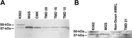 Figure 2. TMD blast cells express only the shorter variant of GATA-1. Whole-cell extracts were prepared using triple-detergent lysis buffer. Proteins were transferred onto polyvinylidene difluoride membranes and processed for reaction with the anti–GATA-1 polyclonal antibody, M-20, which recognizes the C-terminus of GATA-1. (A) CMK, MGS, and blast cells from 3 patients with TMD expressed only the shorter variant of GATA-1. In each lane, 15 μg protein was loaded. (B) An identical sized GATA-1 protein is expressed in MGS and blast cells from a patient with TMD (TMD 21). The predicted protein encoded by the open reading frame of the mutant GATA-1 gene in TMD 21 is 378 amino acids, whereas that of MGS is 330 amino acids. In contrast, blast cells from a patient with AMKL, but not from Down syndrome, expressed full-length GATA-1.