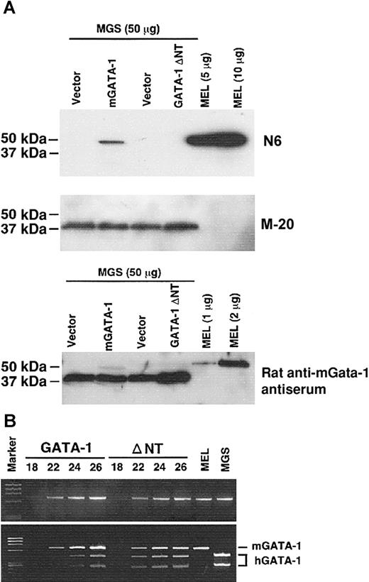 Figure 3. Expression of mGATA-1 in the human DS-AMKL cell line, MGS. (A) Immunoblotting analyses of GATA-1. Full-length mGATA-1 and the short form of mGATA-1 (ΔNT) were retrovirally introduced into MGS cells. Nuclear extracts were transferred onto polyvinylidene difluoride membranes and processed for reaction with the N6 monoclonal antibody, which recognizes the N-terminus of GATA-1 (upper panel), and M-20 polyclonal antibody, which recognizes the C-terminus of GATA-1 (middle panel), and rat anti–mGATA-1 antiserum (lower panel). (B) Semiquantitative RT-PCR analysis of GATA-1 transcripts from MGS cells expressing full-length mGATA-1 (GATA-1) and the short form of mGATA-1 (ΔNT). PCR reactions were performed for the indicated number of cycles using a set of primers (5′ CTACCCTGCCTCAACTGTGT 3′ and 5′ AAGCCACCAGCTGGTCCTTC 3′) corresponding to the sequences with 100% homology between mouse and human GATA-1. PCR products before digestion (upper panel) and after digestion (lower panel) with HindIII were electrophoresed in 2.5% agarose gels.