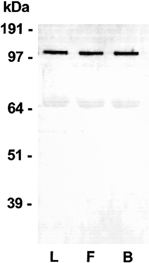 Figure 2. Western Blot of Lewis (L), Fischer (F) and Buffalo (B) rat plasma HK. Blood was collected into sodium citrate (see “Materials and methods”) from each of the rat species. An aliquot was added to a customized LDS-PAGE plasma sample buffer containing reducing agent (see “Materials and methods”). After electrophoresis, blotting, and blocking, the blot was probed using an IgG rabbit antirat HK polyclonal antibody and detected using a goat antirabbit IgG alkaline phosphatase conjugate and BCIP/NBT. A specific band at 110 kDa was observed representing rat HK in the plasma. A nonspecific band at 68 kDa is an artifact of the assay dye reacting with blotted rat albumin.