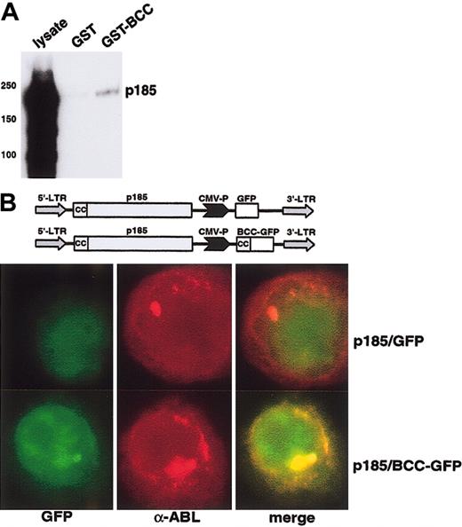 Figure 6. In vitro and in vivo interaction of aa 1 to 63 of BCR (BCC) with p185(BCR-ABL). (A) Pull down of p185(BCR-ABL) by GST-BCC. p185(BCR-ABL)-expressing Ba/F3 cells were incubated with GST and GST-BCC bound to Sepharose beads. The precipitated complexes were resolved on SDS-PAGE and blotted with an α-ABL antibody. (B) Localization of the BCC-GFP fusion peptide in p185(BCR-ABL)-expressing Ba/F3 cells. Cells were stained with the α-ABL antibody α-ABL; red fluorochrome), or GFP, (BCC-GFP expression; green fluorochrome). Colocalization images were obtained by electronic superimposition of the images (merge). Colocalization of fluorochromes yields a yellow color. The retroviral construct is shown at the top. Original magnification, × 100.