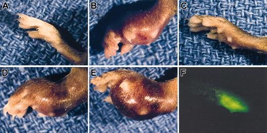 Figure 2. Gross appearance of LLC footpad tumors in mice with single and combined deficits in plasminogen and fibrinogen. A normal, non-tumor–bearing foot (A) is shown along with examples of LLCGFP footpad tumors 14 days after inoculation into control (B), Plg– (C,F), Fib– (D), and Plg–/Fib– (E) mice. Despite the minimal difference in size between the Plg– tumor-bearing foot (C) and a non-tumor–bearing foot (A), the presence of tumor tissue could be easily appreciated using a fluorescence-equipped stereomicroscope (F). Note that the foot in panel F is the same foot shown in panel C and is photographed at the same magnification.
