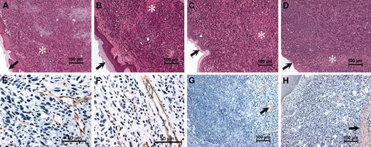 Figure 4. Histologic features of footpad tumors are similar in plasminogen-deficient and control mice. Shown are representative hematoxylin-eosin–stained sections of footpad LLCGFP tumors collected from control (A), Plg– (B), Fib– (C), and Plg–/Fib– (D) mice 14 days after initial transplantation. Note that the overall microscopic features of the tumor tissue were unremarkable within animals of each genotype and suggest no obvious basis for the impediment in tumor growth in Plg– mice. LLCGFP tumors grew as sheets of anaplastic cells that often invaded normal structures, including adjacent muscle and bone. Small areas of necrosis (*) were also present, but these were not appreciably different between animals of each genotype. Dermal surfaces of the footpads are indicated by arrows in panels A to D. Immunohistochemical staining for the endothelial marker PECAM (brown stain) revealed abundant vessels in footpad tumors derived from control (E) and plasminogen-deficient mice (F). Fibrin(ogen) immunostains revealed relatively scant and focal fibrin(ogen) deposition in control (G) and Plg– (H) mice (brown staining highlighted by arrows). Sparse fibrin(ogen) deposition was generally peritumoral or was associated with small areas of necrosis. Sections used for immunohistology were counterstained with hematoxylin.