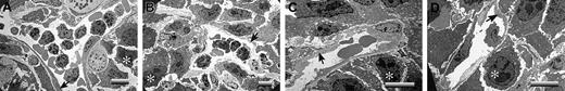 Figure 6. Microvascular patency is maintained within LLC tumors of plasminogen-deficient mice when the tumors develop within the dorsal subcutis. Representative transmission electron micrographs illustrating dorsal skin tumor vasculatures of control (A), Plg– (B), Fib– (C), and Plg–/Fib– (D) mice. Note that in contrast to tumors grown in the footpad, tumors within the dorsal subcutis had no evidence of microvascular thrombus formation, regardless of animal genotype. Viable tumor cells are highlighted with asterisks, and endothelium is indicated with arrows. Horizontal bars in each micrograph indicate 8 μm.