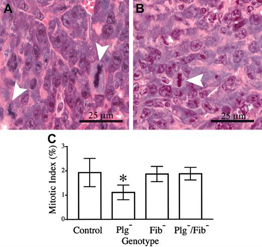Figure 7. Tumor cell mitotic index is diminished in footpad tumors derived from plasminogen-deficient mice relative to control animals. Mitotic figures (arrowheads) were easily discernible in hematoxylin-eosin–stained sections of footpad tumors from control (A) and plasminogen-deficient (B) mice. (C) Quantitative analysis of mitotic indices within footpad tumors of mice with single and combined deficits in plasminogen and fibrinogen. The mitotic index observed in plasminogen-deficient (*) mice was significantly less than that observed in control animals (P < .02). In contrast, no significant difference in mitotic index was observed in comparative analyses of control animals and plasminogen-deficient mice that also lacked fibrinogen (P > .8). Mitotic indices were also similar in control and fibrinogen-deficient mice (P > .9). All P values were established using the Mann-Whitney U test. Error bars indicate standard deviation from the mean value for 6 mice.