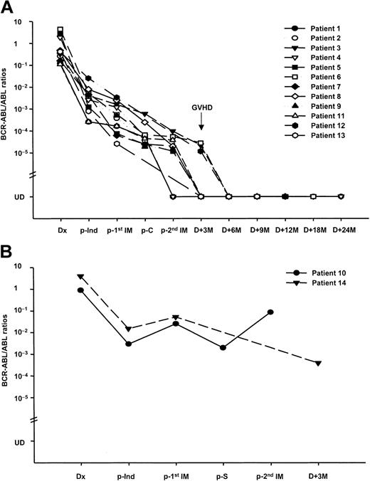 Figure 1. Sequential assessment of the BCR-ABL kinetics. The 118 bone marrow samples from 14 Ph+ ALL patients treated with a first-line interim therapy of imatinib prior to allogeneic SCT were assessed by RQ-PCR. (A) Plot shows quantitative BCR-ABL values for 12 responders. After the first imatinib cycle, 11 patients remained in sustained CHR with a decrease in their BCR-ABL/ABL ratios (0.89 logs), and one patient (no. 12) who was refractory achieved a CHR. Of these, 10 patients received the second imatinib cycle following consolidation and showed a sustained CHR, including 2 molecular CRs, with a further decrease in the BCR-ABL/ABL ratios (0.19 logs). All patients underwent SCT in a favorable status, and of these, 11 are alive in a leukemia-free status 9 to 28+ months after SCT. An interesting phenomenon involving a decreased BCR-ABL/ABL ratio to a PCR-negative status after the development of GVHD induced by rapid cyclosporine withdrawal was observed in patient nos. 3, 6, and 12. (B) Plot shows quantitative BCR-ABL values for 2 nonresponders. One patient (no. 10) showing a CHR after chemotherapy developed an overt hematologic relapse with an increase in the BCR-ABL/ABL ratio after each imatinib cycle and died of sepsis prior to SCT. The other patient (no. 14) showed no response to the first imatinib cycle and proceeded directly to SCT. The patient died of refractory grade IV acute GVHD. The patients' characteristics and treatment outcomes are listed in Table 1. Dx indicates diagnosis; p, post; Ind, induction; C, consolidation; IM, imatinib; S, salvage chemotherapy; M, months; and UD, undetectable.