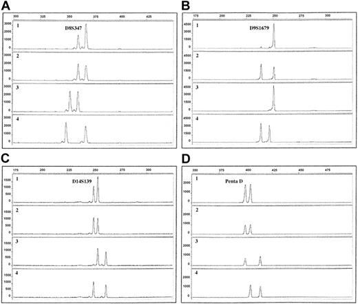 Figure 1. Electropherograms of QF-PCR products using 4 different microsatellite markers. The x-axis displays the lengths of the PCR products in base pairs, determined by the use of an internal size standard. The y-axis displays the fluorescence activity in arbitrary units. Row 1, ALL sample; row 2, remission sample; row 3, maternal sample; row 4, paternal sample. (A) Patient 9, marker D8S347, showing duplication of the paternal allele (ratio 1.8). (B) Patient 10, marker D9S1679, showing LOH with retention of the maternal allele. (C) Patient 5, marker D14S139, showing duplication of the maternal allele (ratio 1.6). (D) Patient 10, marker Penta D, showing tetrasomy 21, visible as equal allele dosage (ratio 1.0).