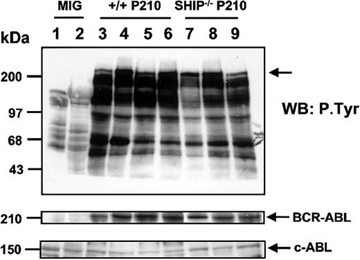 Figure 5. Similar tyrosine phosphorylation of BCR-ABL in BCR-ABL– transduced +/+ and SHIP–/– leukemic murine cells. Shown are Western blot analyses of cell lysates from the spleen and liver of a control (MIG-transduced) mouse (lanes 1-2), the spleen and liver of sick mice initially receiving transplants with 103 and 5 × 103 BCR-ABL–transduced Sca-1+lin– GFP+ cells (lanes 3-6), and cell lysates from the spleen and liver of sick mice injected with similar numbers of Sca-1+lin–GFP+ cells from BCR-ABL–transduced SHIP–/– cells (lanes 7-9). Lysates from equal numbers of cells were separated on 8% polyacrylamide gradient gels. The filter was first probed with an antiphosphotyrosine (4G10) antibody, then stripped and reprobed with an anti-ABL antibody (8E9). The positions of prestained molecular weight markers are indicated on the left side of the blot.