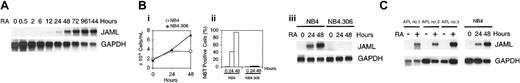 Figure 2. Induction of JAML mRNA in RA-treated cells. (A) Time-response to ATRA in NB4 cells. Cells were treated for different times using 5 × 10-7 M ATRA. (B) JAML expression correlates with the capacity of NB4 cells to differentiate. NB4 and NB4.306 cells were cultured with 10-6 M ATRA and harvested after 0, 24, and 48 hours. Viable cells (i) and percent of NBT-positive cells (ii) were counted each day and JAML mRNA expression was analyzed (iii). (C) JAML mRNA is induced in ATRA-treated primary APL cells. Cells were purified from 3 untreated patients cultivated in the absence (–) or presence (+) of 10-7 M ATRA for 5 (APL no. 2)or6(APL no. 1 and APL no. 3) days. Northern blots were performed using 8 μg (A,Biii) or 2 μg (C) total RNA. Hybridization with a glyceraldehyde phosphate dehydrogenase (GAPDH) probe controlled for RNA quantities in each lane.